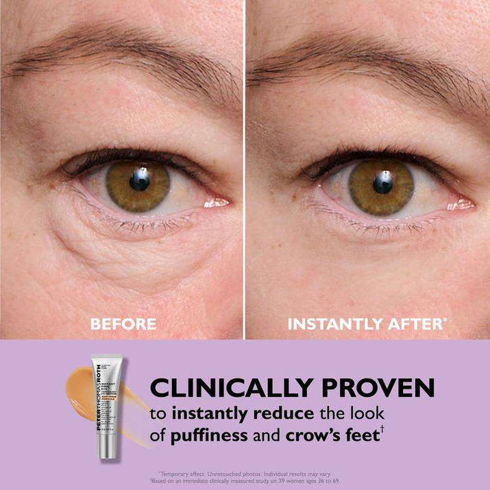 Radiant Eye Renewal Cream™