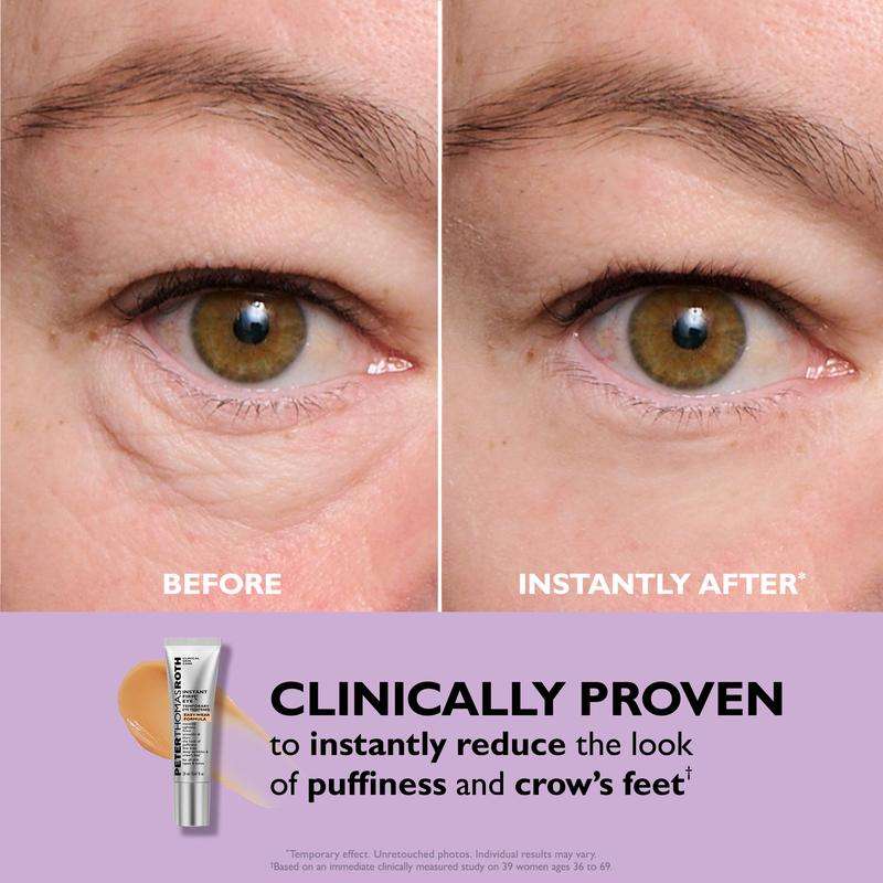 Radiant Eye Renewal Cream™